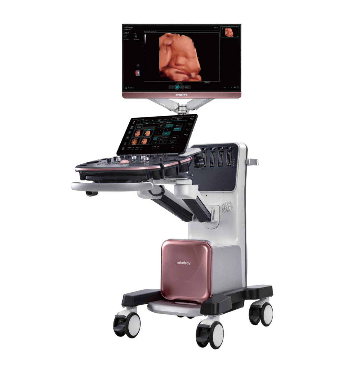 Ultrasound