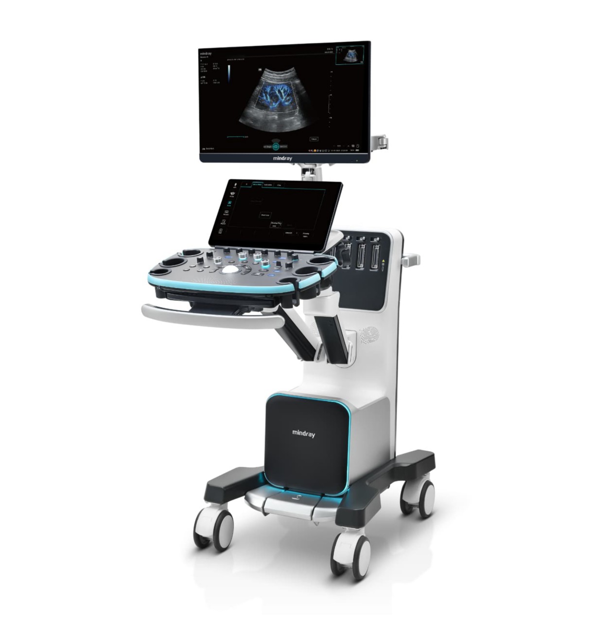 Ultrasound